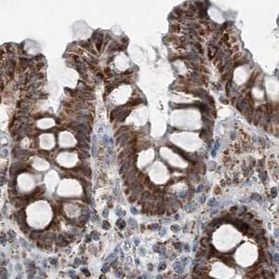 Immunohistochemistry-Paraffin: SUCLG1 Antibody [NBP2-38318]