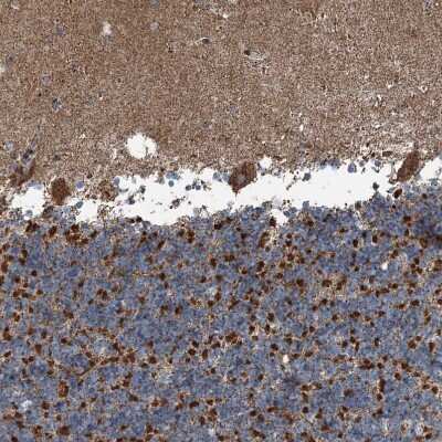 Immunohistochemistry-Paraffin: SUCLG1 Antibody [NBP2-38318]