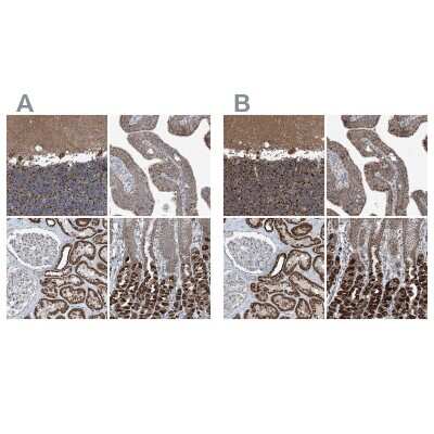 Immunohistochemistry-Paraffin: SUCLG1 Antibody [NBP2-38318]