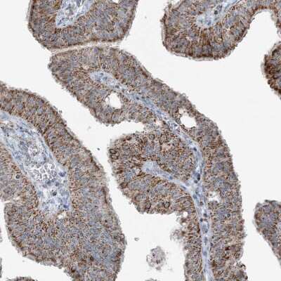 Immunohistochemistry-Paraffin: SUCLG1 Antibody [NBP2-38318]