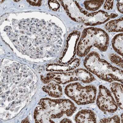 Immunohistochemistry-Paraffin: SUCLG1 Antibody [NBP2-38318]