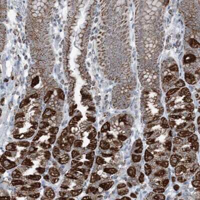 Immunohistochemistry-Paraffin: SUCLG1 Antibody [NBP2-38318]
