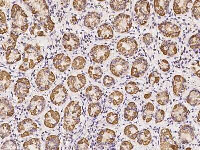 Immunohistochemistry-Paraffin: SUCLG1 Antibody [NBP2-97325]