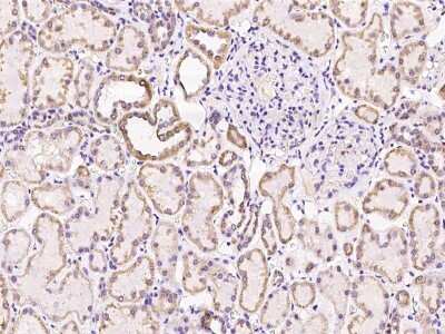 Immunohistochemistry-Paraffin: SUCLG1 Antibody [NBP2-97325]