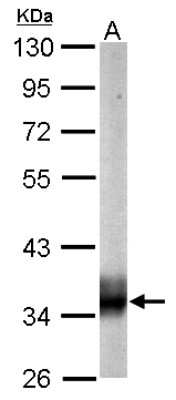 Western Blot: SUCLG1 Antibody [NBP1-32728]