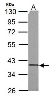 Western Blot: SUCLG1 Antibody [NBP1-32728]