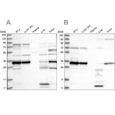 Western Blot: SUCLG1 Antibody [NBP1-89489]