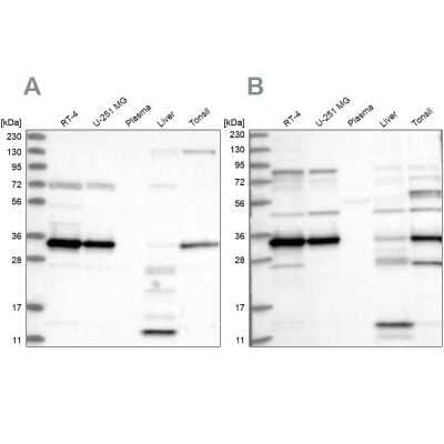 Western Blot: SUCLG1 Antibody [NBP2-38318]