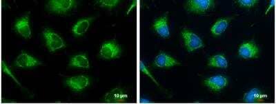 Immunocytochemistry/ Immunofluorescence: SUCLG2 Antibody [NBP1-32521]