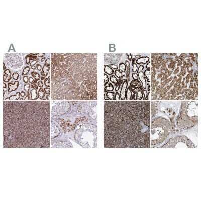 Immunohistochemistry-Paraffin: SUCLG2 Antibody [NBP2-47610]