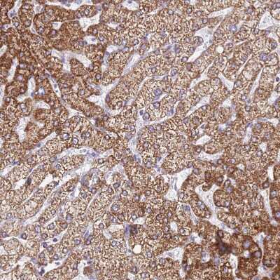 Immunohistochemistry-Paraffin: SUCLG2 Antibody [NBP2-47610]