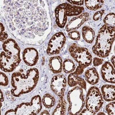 Immunohistochemistry-Paraffin: SUCLG2 Antibody [NBP2-47610]