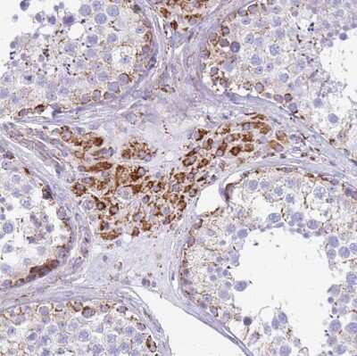 Immunohistochemistry-Paraffin: SUCLG2 Antibody [NBP2-47610]