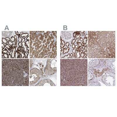 Immunohistochemistry-Paraffin: SUCLG2 Antibody [NBP2-49029]