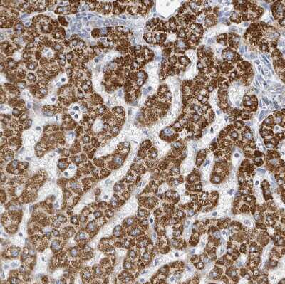 Immunohistochemistry-Paraffin: SUCLG2 Antibody [NBP2-49029]