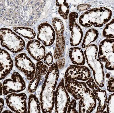 Immunohistochemistry-Paraffin: SUCLG2 Antibody [NBP2-49029]
