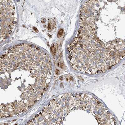 Immunohistochemistry-Paraffin: SUCLG2 Antibody [NBP2-49029]
