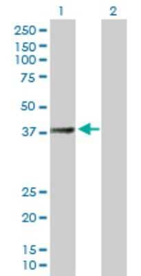 Western Blot: SUCLG2 Antibody [H00008801-B01P]