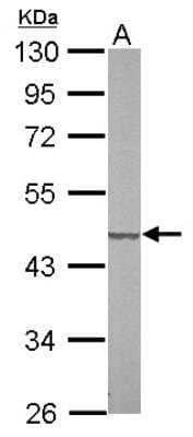 Western Blot: SUCLG2 Antibody [NBP1-32521]
