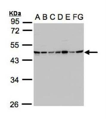 SUCLG2 Antibody (NBP1-32521) by Novus, Part of Bio-Techne