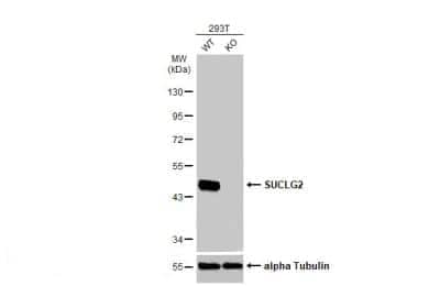 Western Blot: SUCLG2 Antibody [NBP1-32521]