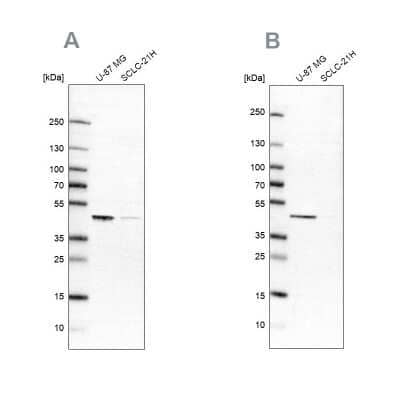 Western Blot: SUCLG2 Antibody [NBP2-47610]