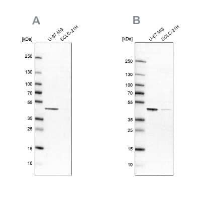 Western Blot: SUCLG2 Antibody [NBP2-49029]