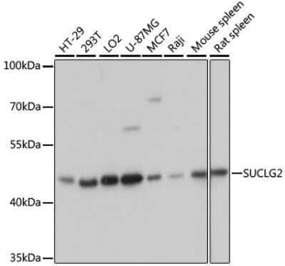 Western Blot: SUCLG2 AntibodyAzide and BSA Free [NBP2-94914]