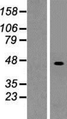 Western Blot: SUCLG2 Overexpression Lysate [NBP2-07942]