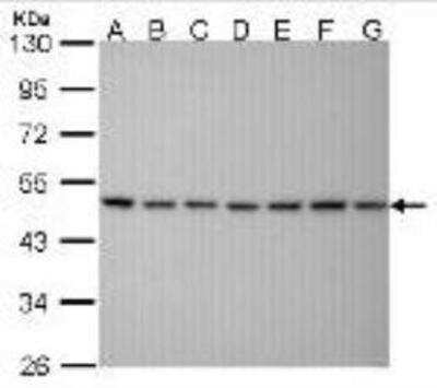 Western Blot: SUG1 Antibody (25D5) [NB100-345]