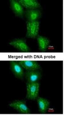 SUG1 Antibody (NBP1-33309) by Novus, Part of Bio-Techne