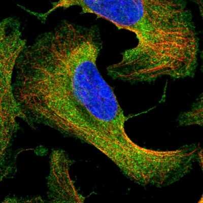 Immunocytochemistry/ Immunofluorescence: SUG1 Antibody [NBP2-57621]