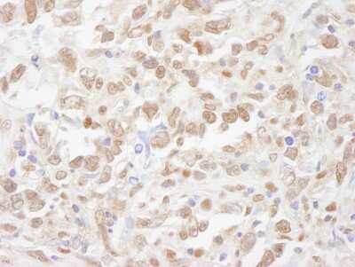 Immunohistochemistry-Paraffin: SUG1 Antibody [NB100-2572]