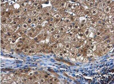 Immunohistochemistry-Paraffin: SUG1 Antibody [NBP1-33309]