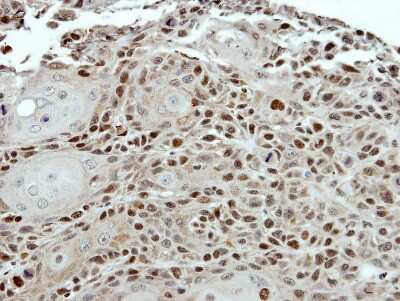 Immunohistochemistry-Paraffin: SUG1 Antibody [NBP2-20529]