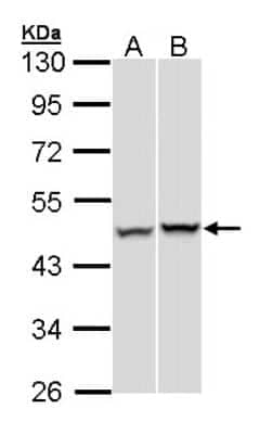 Western Blot: SUG1 Antibody [NBP1-33309]