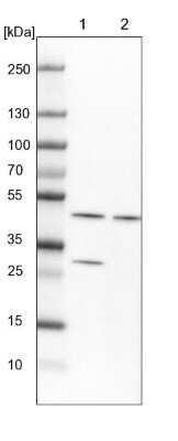 Western Blot: SUG1 Antibody [NBP1-87372]