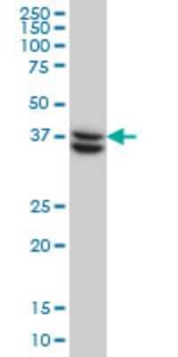 Western Blot: SUGT1 Antibody (6G5) [H00010910-M03]