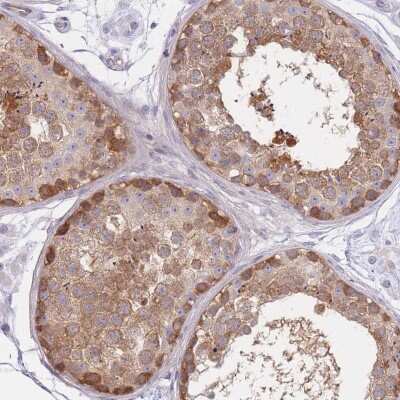 Immunohistochemistry: SUGT1 Antibody [NBP2-38518]