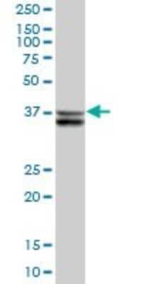 Western Blot: SUGT1 Antibody [H00010910-B01P]