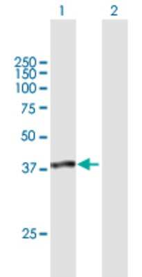 Western Blot: SUGT1 Antibody [H00010910-B01P]