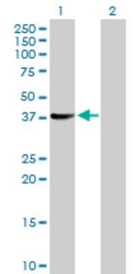 Western Blot: SUGT1 Antibody [H00010910-D01P]