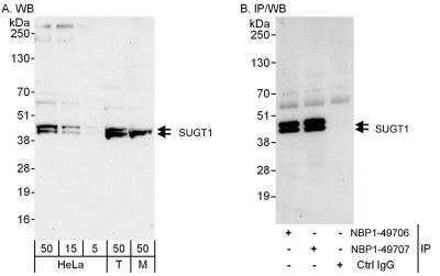 Western Blot: SUGT1 Antibody [NBP1-49707]