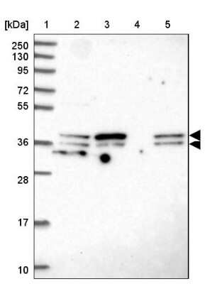 Western Blot: SUGT1 Antibody [NBP2-38518]