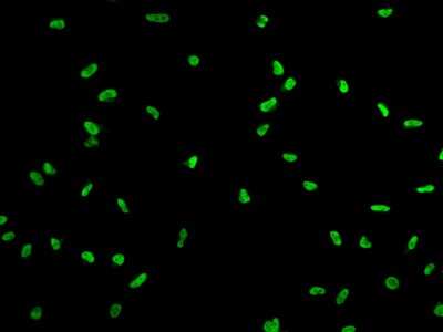 Immunocytochemistry/ Immunofluorescence: SUHW1 Antibody [NBP2-98117]