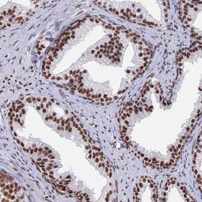 Immunohistochemistry-Paraffin: SUHW1 Antibody [NBP1-92459]