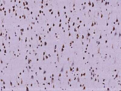 Immunohistochemistry-Paraffin: SUHW1 Antibody [NBP2-98117]
