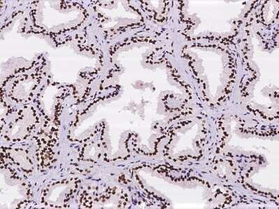 Immunohistochemistry-Paraffin: SUHW1 Antibody [NBP2-98117]