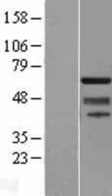 Western Blot: SUHW1 Overexpression Lysate [NBL1-18108]