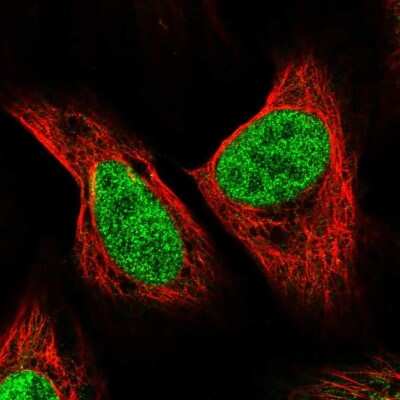 Immunocytochemistry/ Immunofluorescence: SUHW2 Antibody [NBP2-49299]